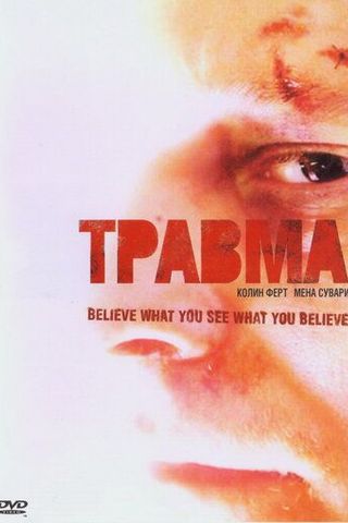 Травма