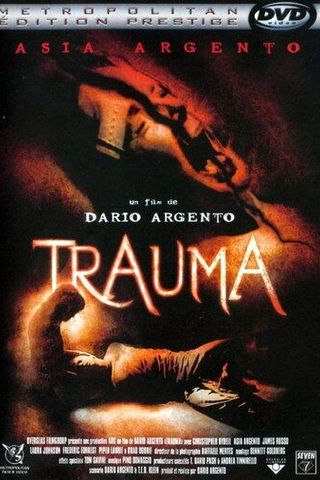 Травма