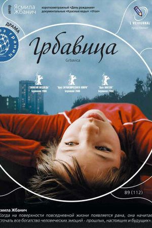 Грбавица